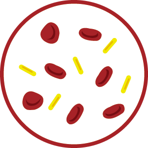 Leukoreduction Leukoreduction