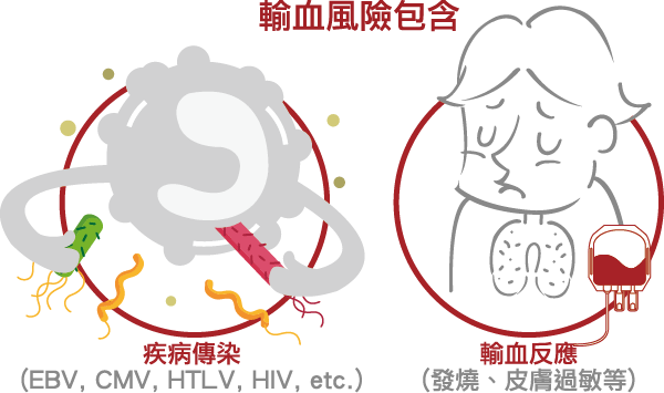 白血球減除 白血球減除